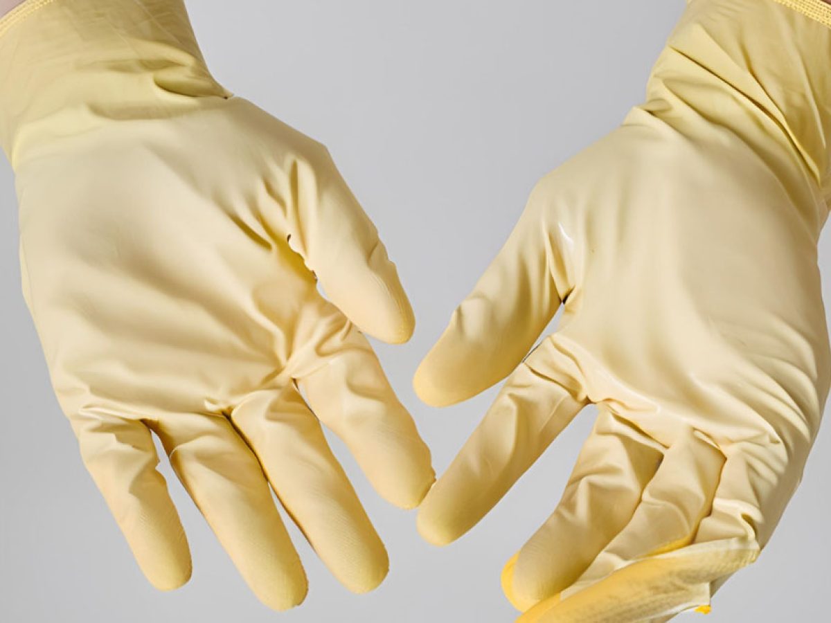 găng tay y tế bị vàng
