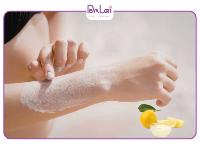 Cách trị nám tàn nhang đồi mồi tại nhà