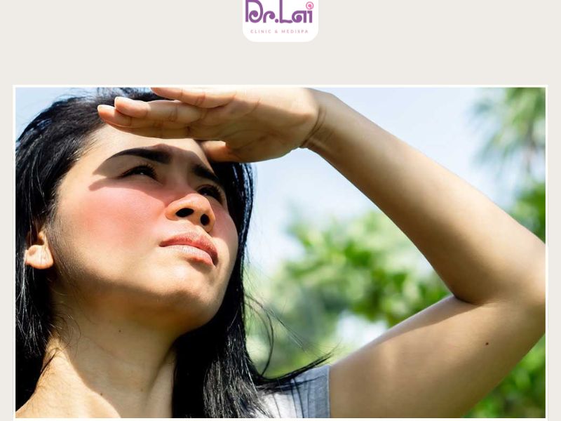 Tác động từ ánh nắng mặt trời