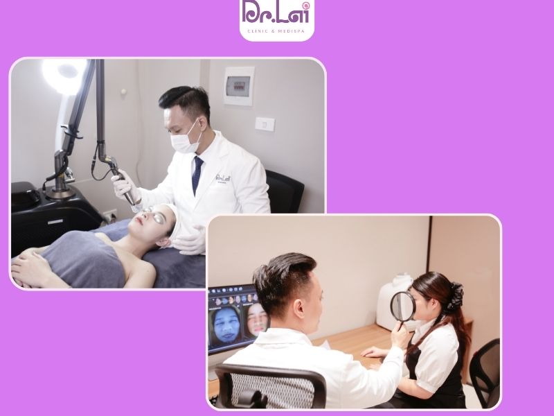 Cách giúp quá trình làm HIFU dễ chịu hơn