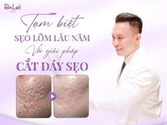8 bước chăm sóc da sau cắt đáy sẹo để giảm thâm, giảm viêm
