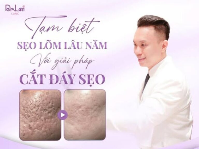 8 bước chăm sóc da sau cắt đáy sẹo để giảm thâm, giảm viêm