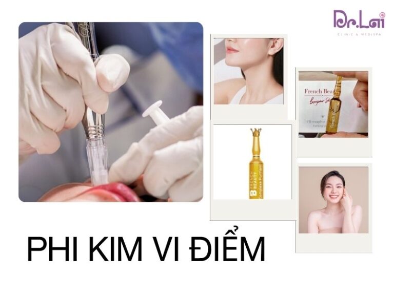 4 tiêu chí đánh giá một địa chỉ điều trị mụn đáng tin cậy
