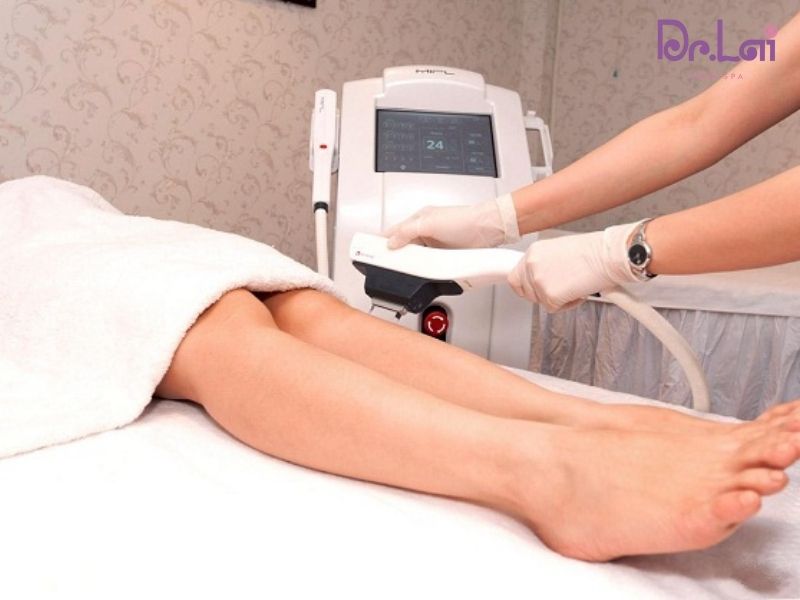 Công nghệ Laser IPL