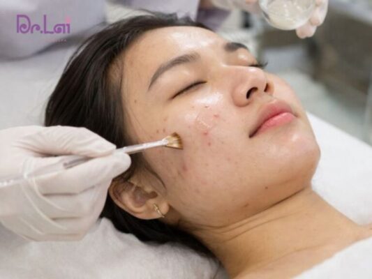 Sản phẩm dưỡng ẩm dịu nhẹ
